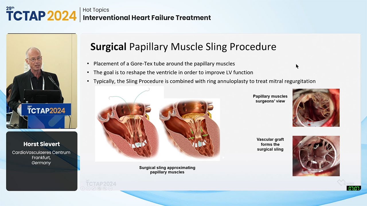 [TCTAP 2024] Hot Topics - Interventional Heart Failure Treatment