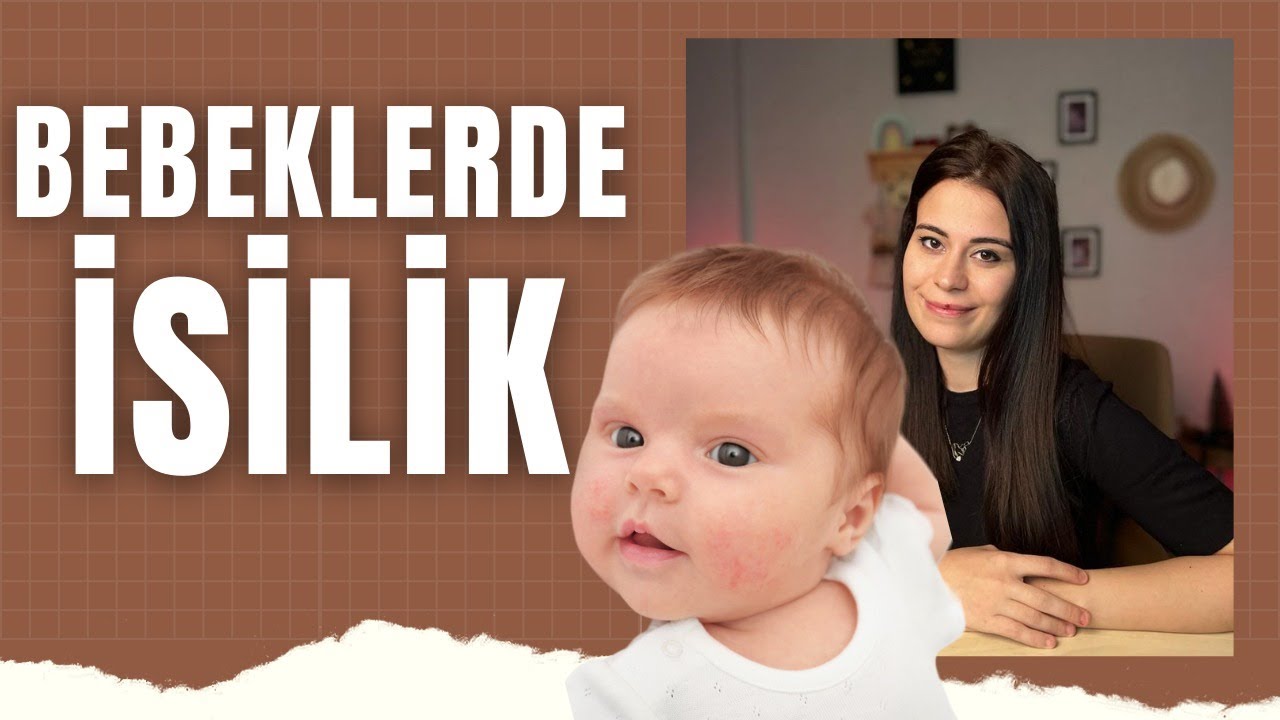 Bebeklerde İsilik Neden Olur | Nasıl Önlem Alınmalıdır | Tedavi Gerektirir mi?