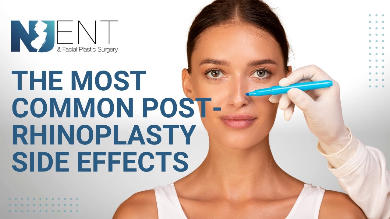 The Most Common Post-Rhinoplasty Side Effects | We Nose Noses