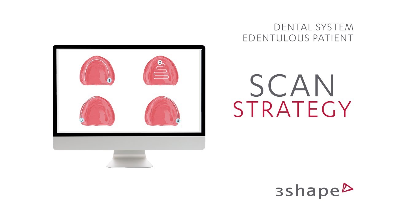 3Shape TRIOS Scan Strategy - Edentulous patient