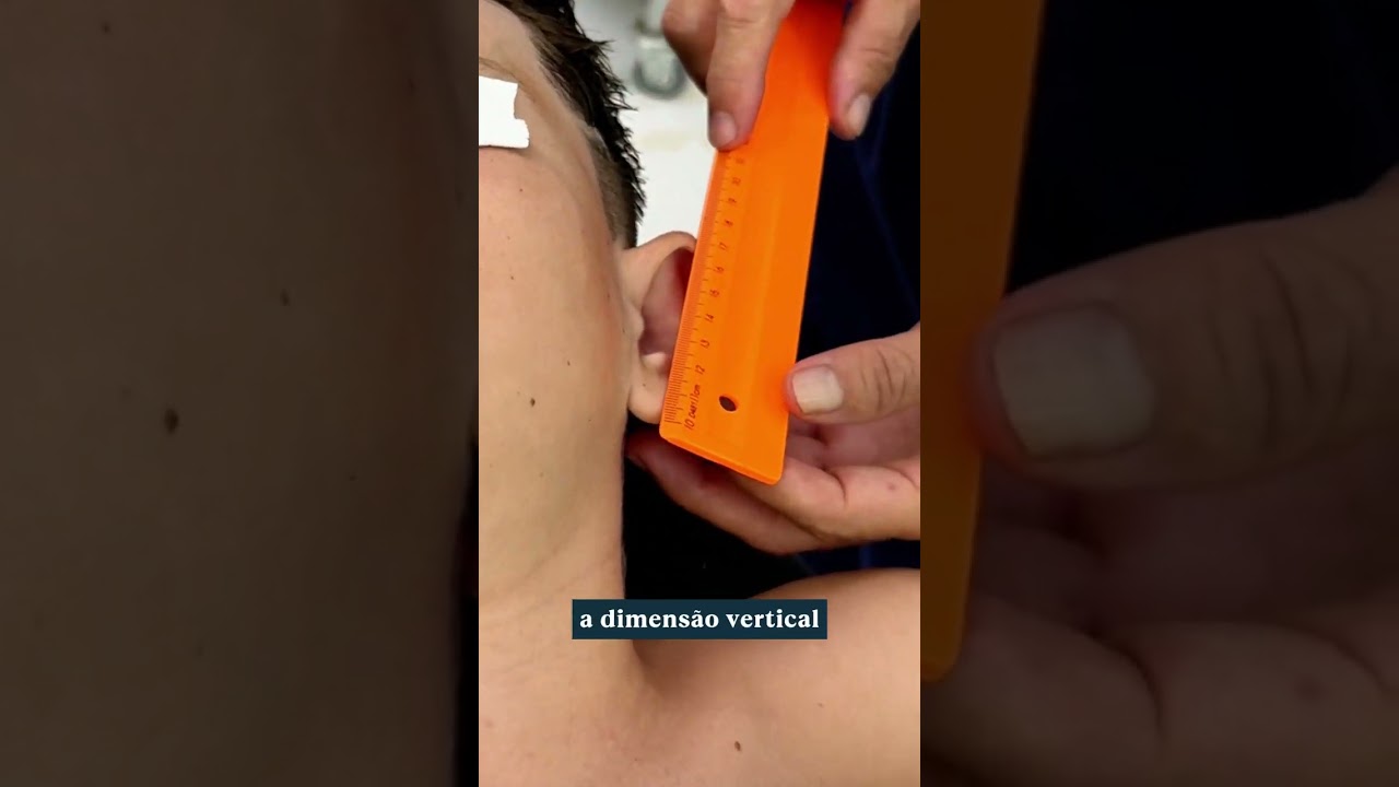 📝 Macrotia...j&aacute; ouviu falar? &Eacute; quando a orelha, al&eacute;m de aberta, &eacute; grande! 👂