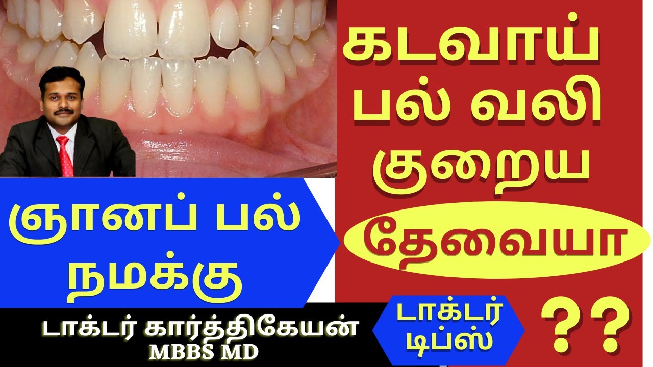 wisdom teeth removal tooth pain | கடைவாய் பல் பிடுங்குதல் கடவா பல் வலி குணமாக | dr karthikeyan