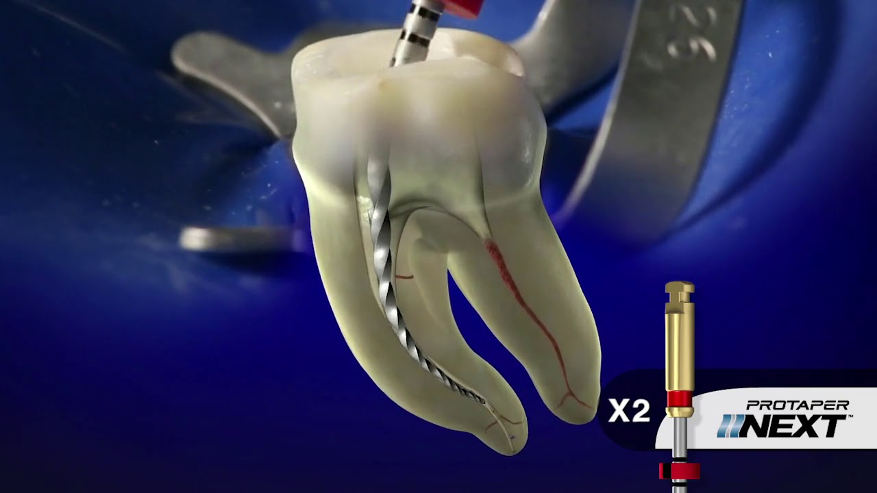 PROTAPER NEXT® Clinical with Dr. Ruddle | Dentsply Sirona
