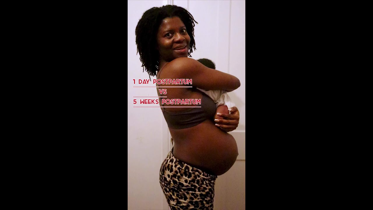 Watch this post baby body transformation 😭 