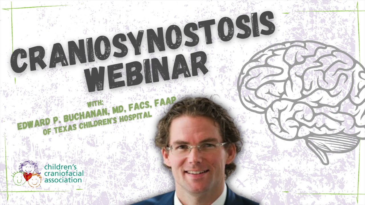 Craniosynostosis Webinar with Dr. Buchanan
