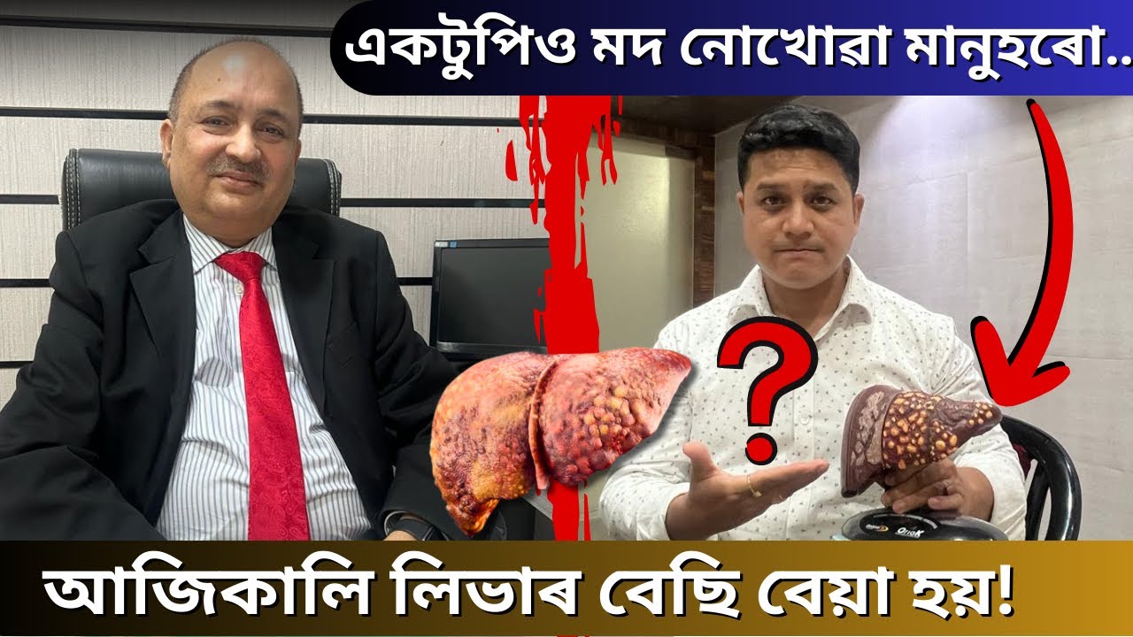 মাৰাত্মক l আপোনাৰ শৰীৰৰ ভয়ংকৰ পৰিঘটনা অথচ আপুনি গমেই নাপাই l