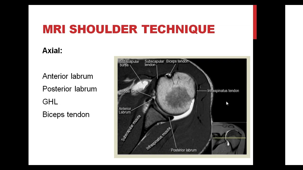 Shoulder MRI