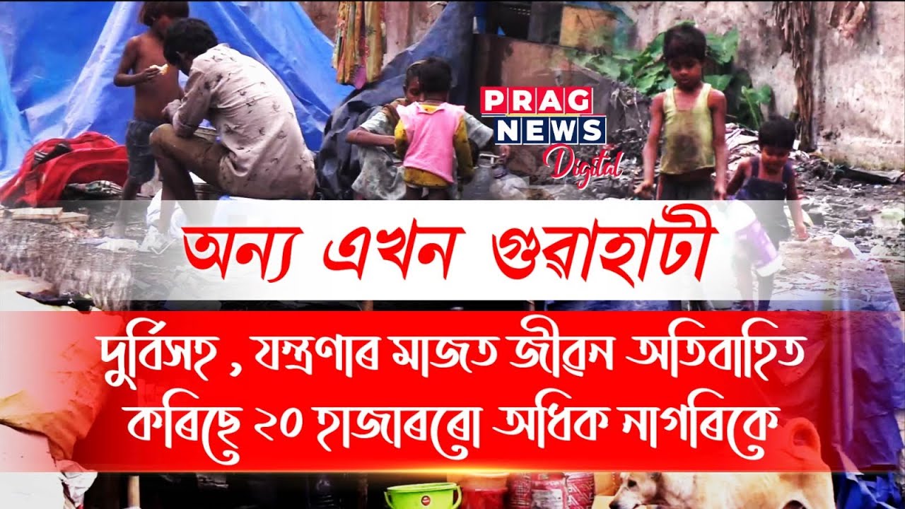 Another side of Guwahati city! More than 20,000 people are living in slums