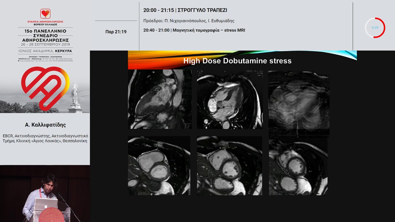 Α. Καλλιφατίδης  | Μαγνητική τομογραφία – stress MRI