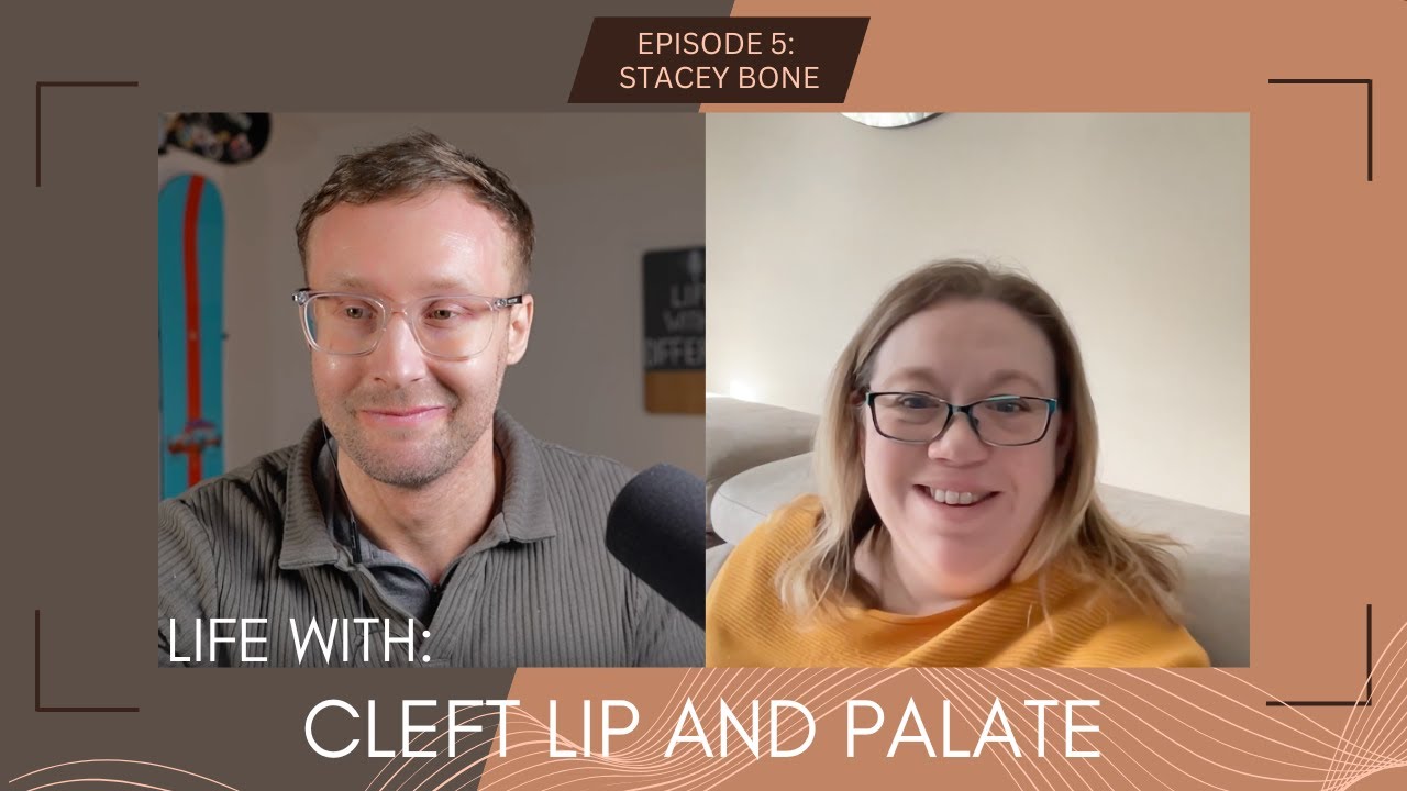 Life with a cleft lip and palate: Stacey Bone