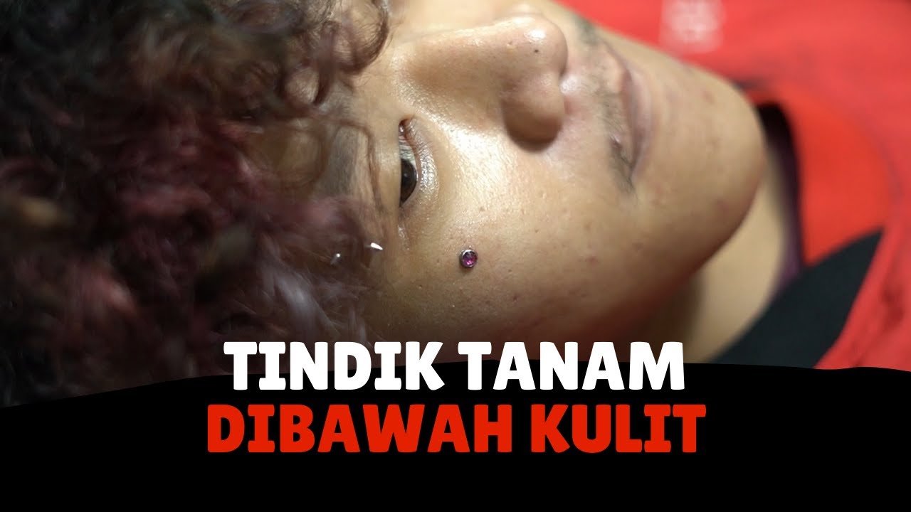 Tindik Tanam Dibawah Kulit, Bahaya Ga Sih? - Tindik Piercing di Muka Ga boleh Sembarangan
