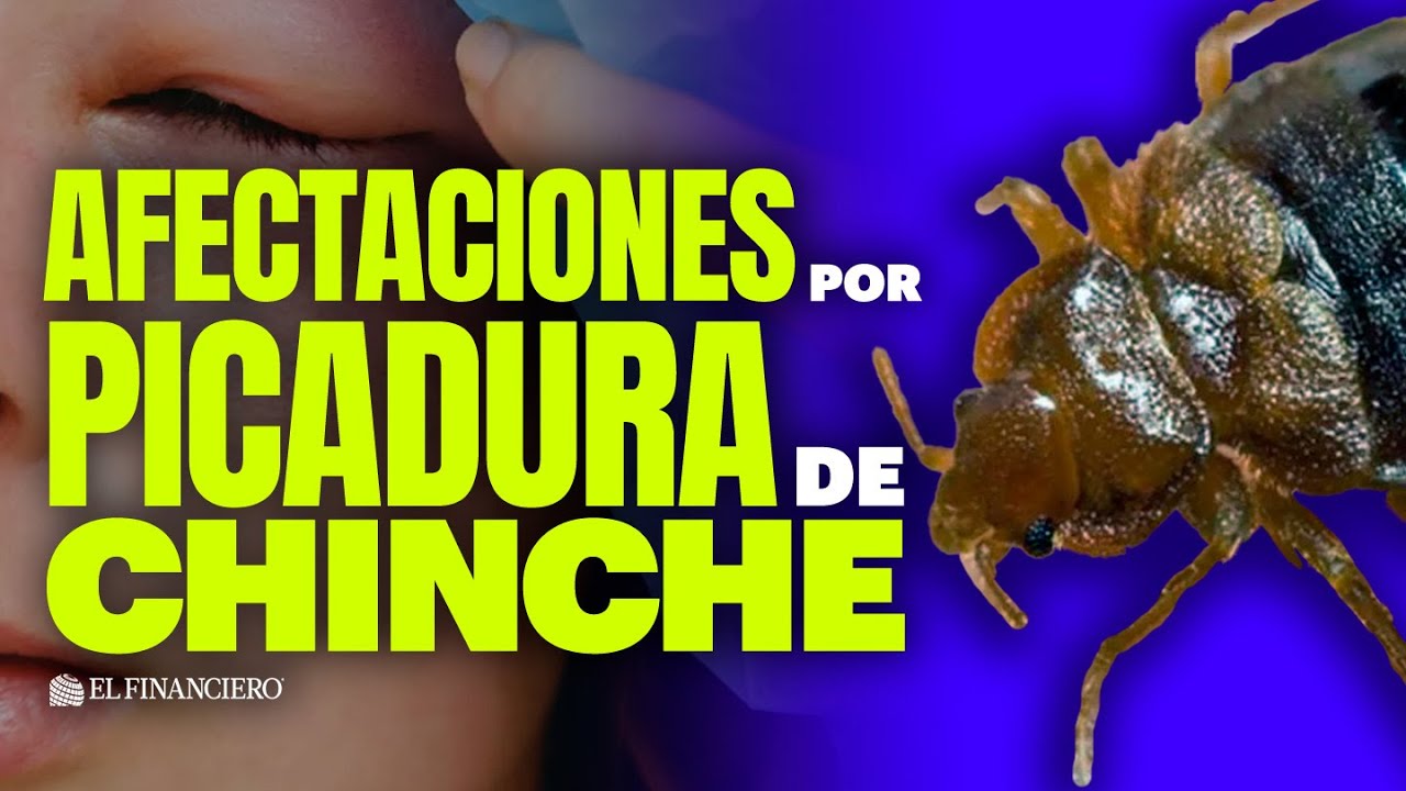 Esta es la enfermedad de Chagas, transmitida por CHINCHES
