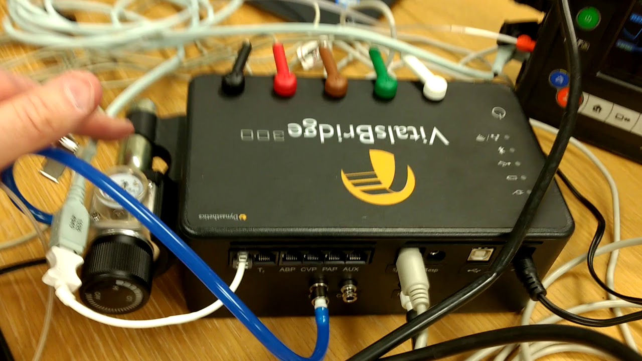 VitalsBridge 300 demo and setup using Tempus Pro monitor