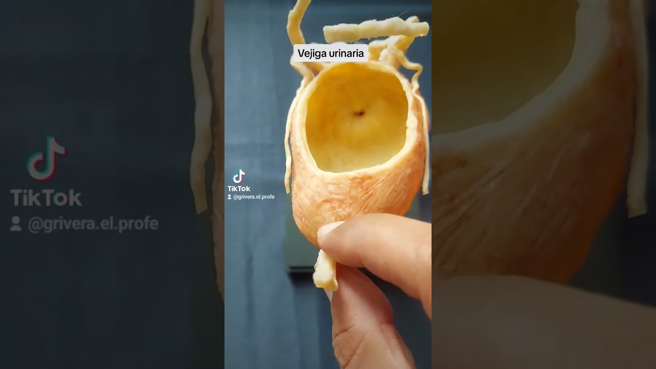 La vejiga humana plastinada
