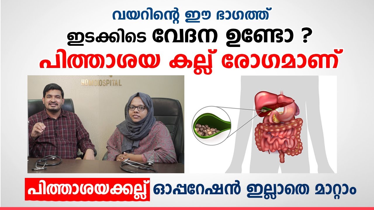 വയറിന്റെ ഈ ഭാഗത്ത് ഇടക്കിടെ വേദന ഉണ്ടോ പിത്താശയ കല്ലാണ് | Gall bladder stone Tips Malayalam /Arogyam
