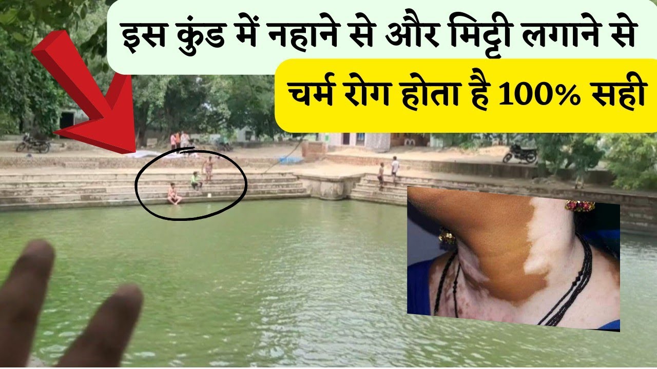 इस कुंड में नहाने से हो जाते है चर्म रोग 100% सही, डॉक्टर भी परेशान होता कैसे है 😱