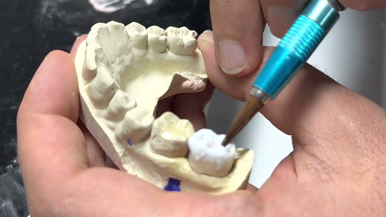 Bölüm 2 Tek üye(kron) porselen diş ikinci pişime nasıl hazırlanır? 🦷