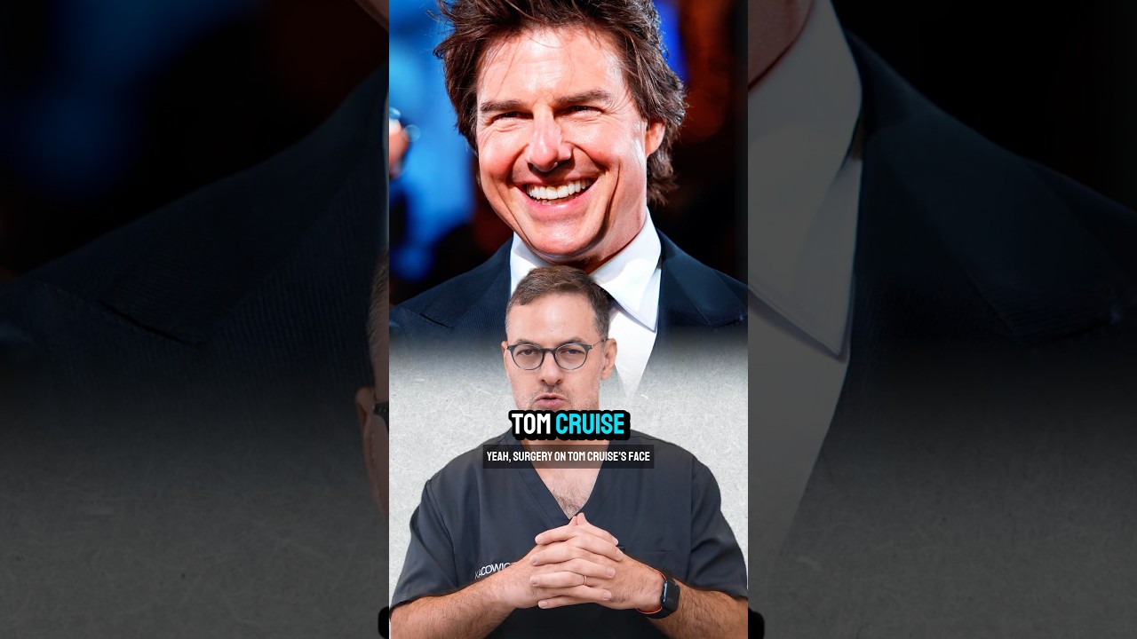 Tom Cruise tem cirurgia? Antes e depois #shorts