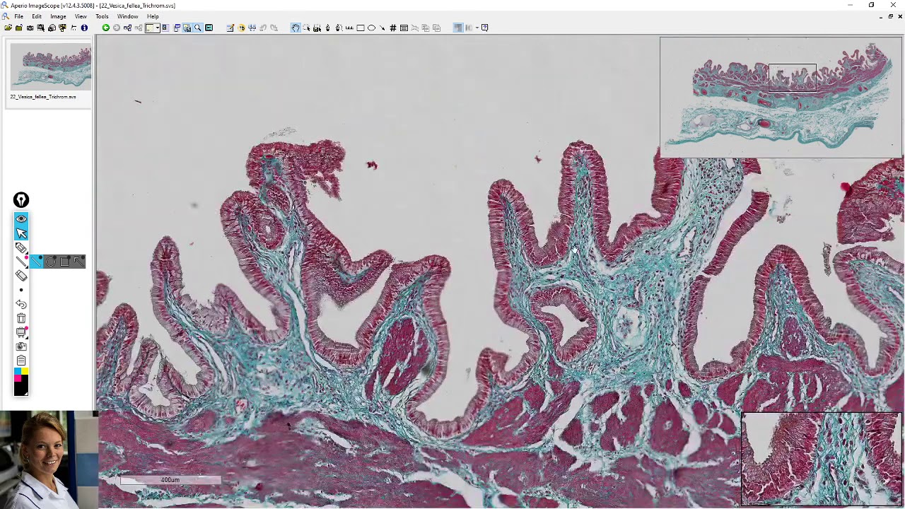 vesica fellea (žlučník)