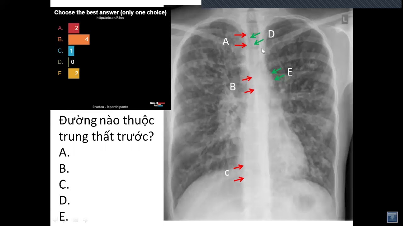xq phoi bs thuan end 1