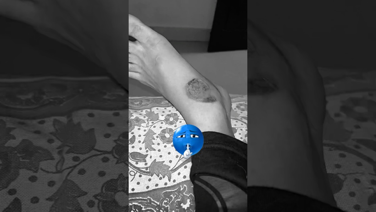 Wait for it💀#bike #gt650 #caferacer #accident #royalenfield #bikelovers #gymrat #relatable #shorts