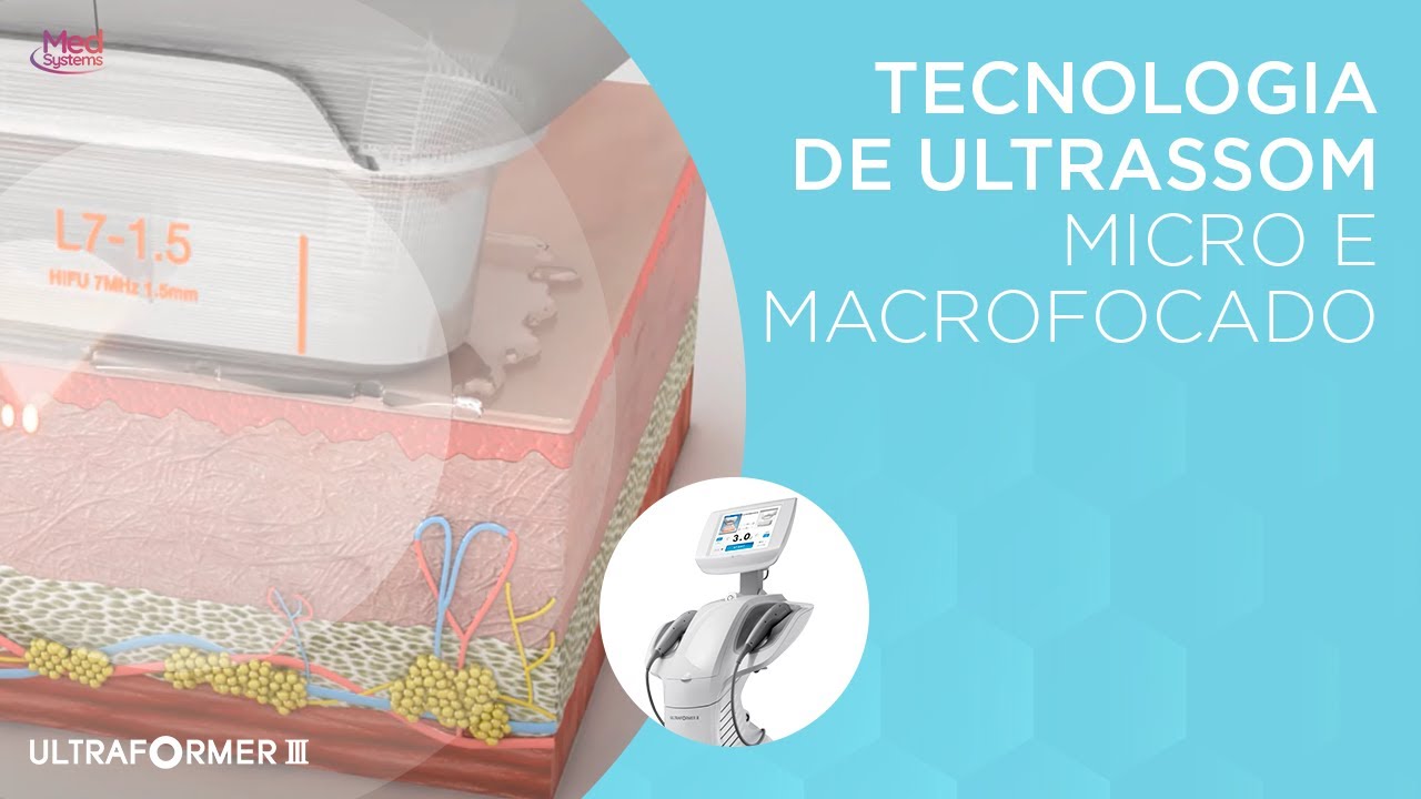 Ultraformer 3 - Aplicações e Depoimentos | Medsystems