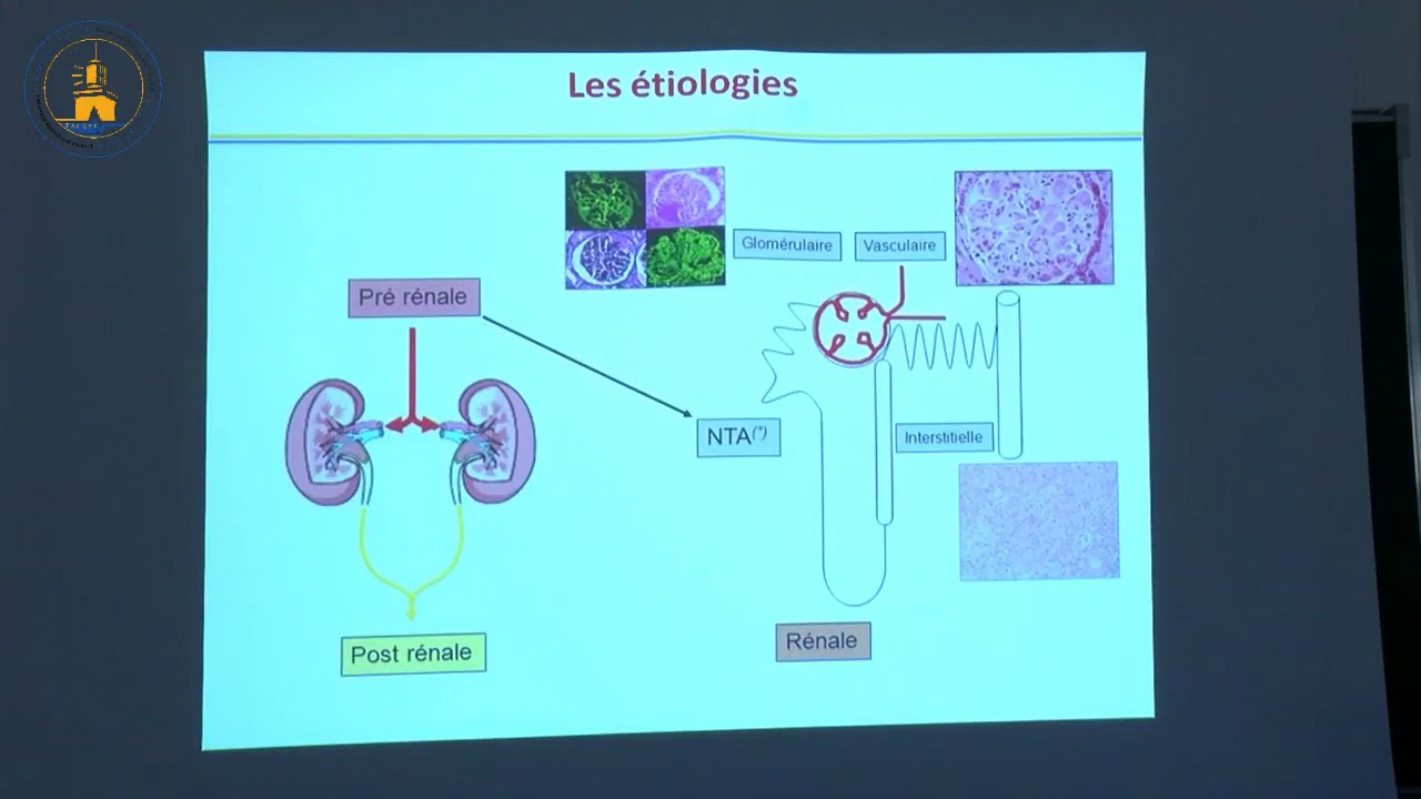 Insuffisance rénale aiguë  chez l'enfant