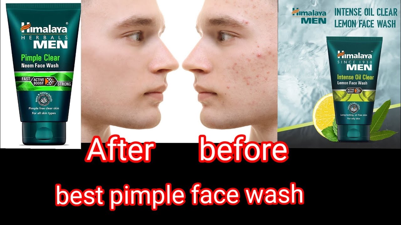 Himalaya men face wash pimple review