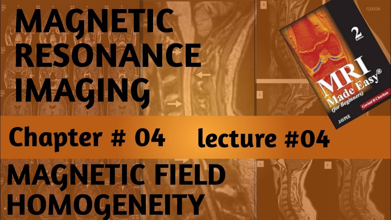 #magnetic field homogeneity//shim coils//active and passive shim coils//MRI//Radiology