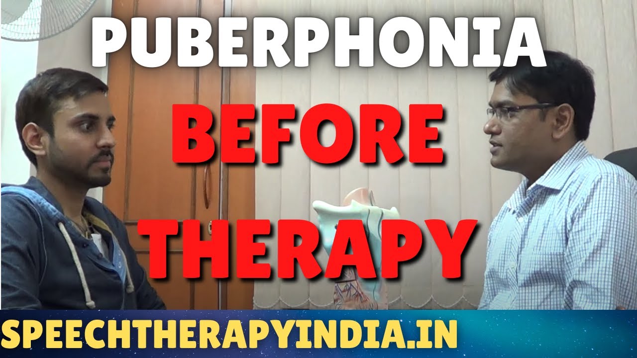 SLP Sanjay Kumar: Before Puberphonia Therapy || Within 3 Days || High Pitch Voice || London Guy