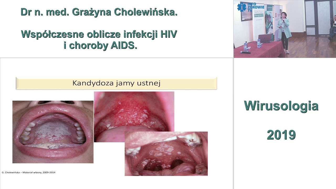 Współczesne oblicze infekcji HIV i choroby AIDS