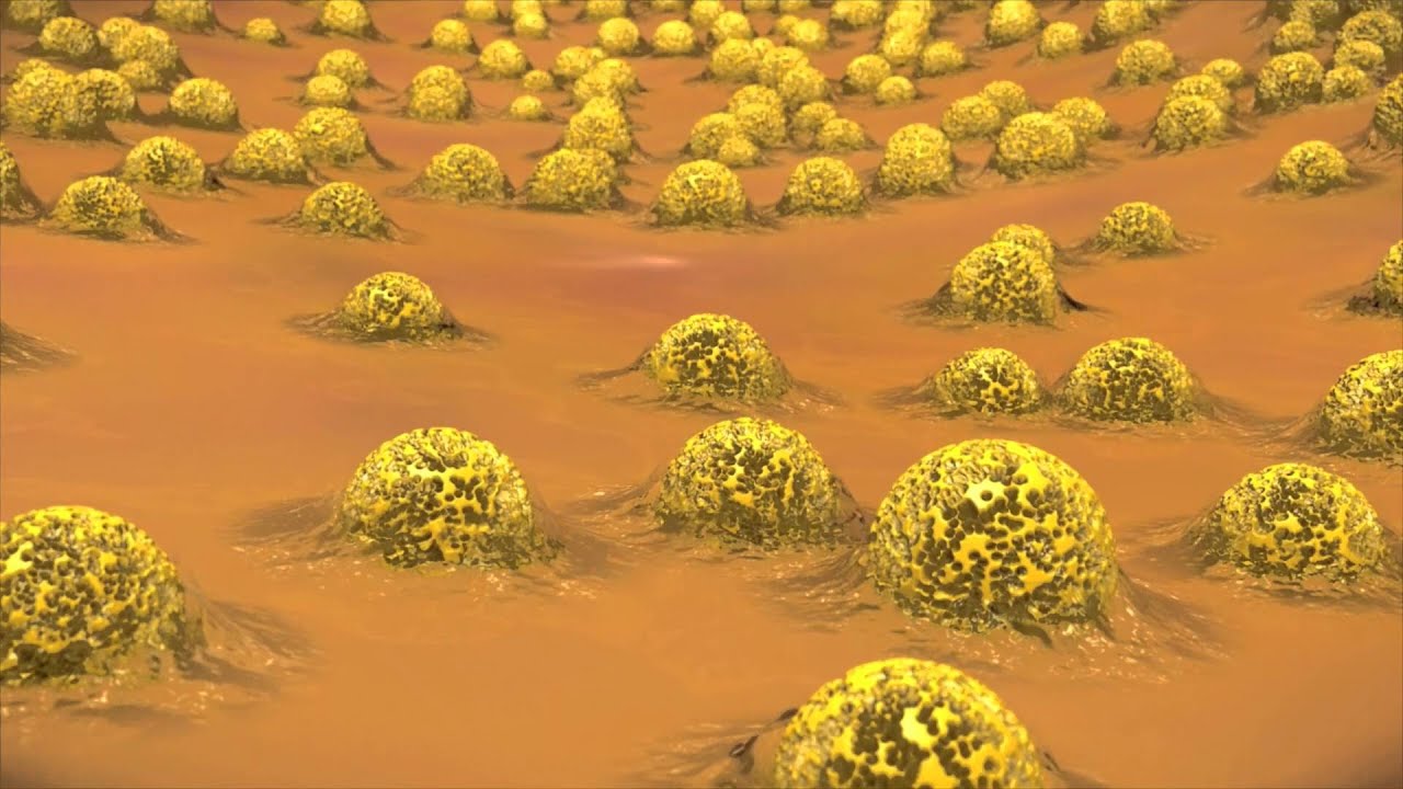The Role of ARESTIN® in Periodontal Treatment