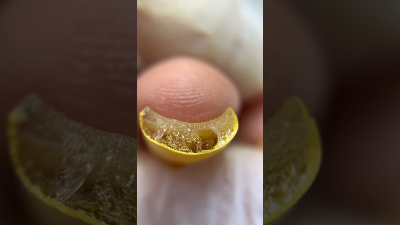 ¿¡Peligrosos HONGOS En Las Uñas!? O… 😳😱🤯