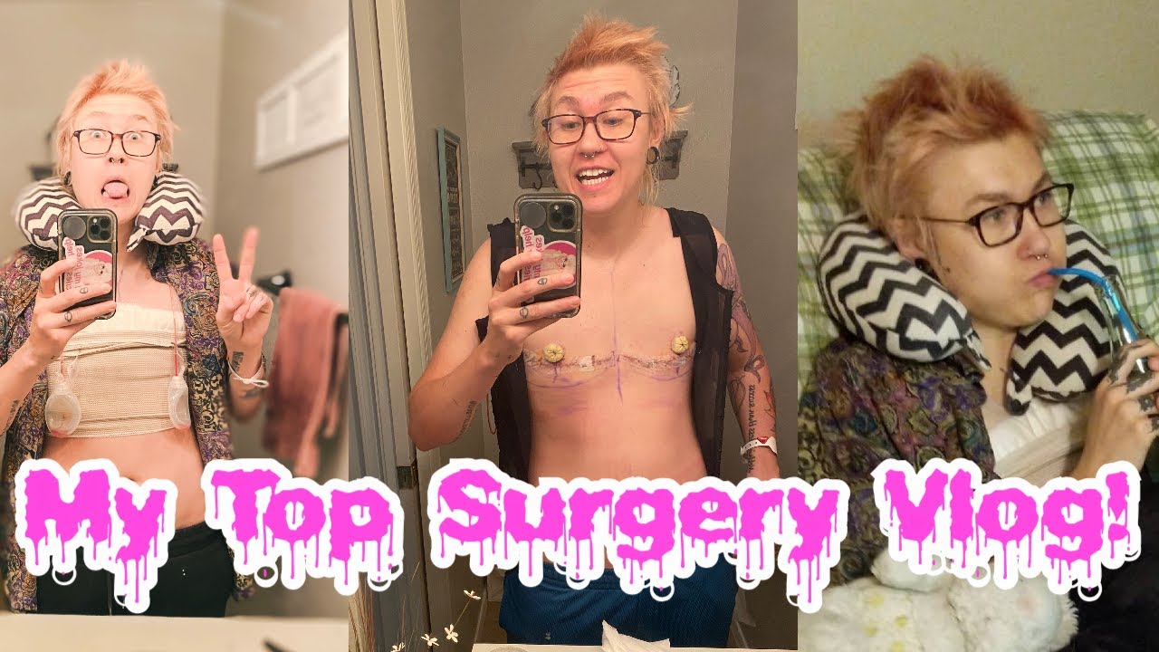 My FTM top surgery vlog!!