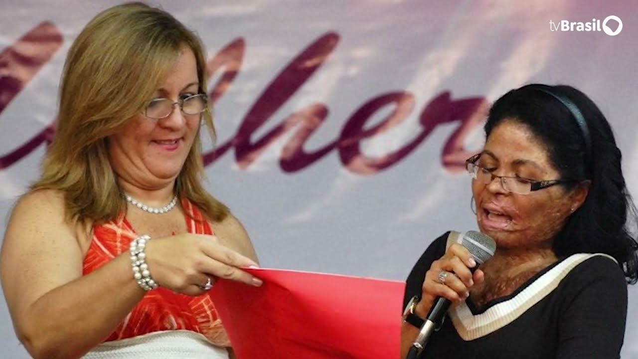Rosângela Sá, sobrevivente de tentativa de fem1nicídi0, agora trabalha com ativismo feminino