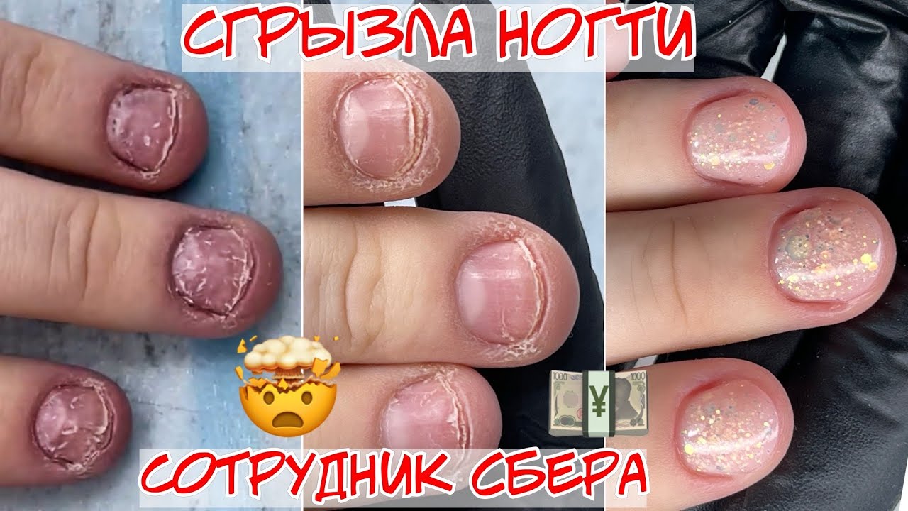 Как восстановить обкусанные ногти? / Грызуны