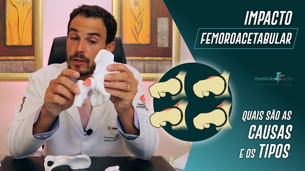 Impacto Femoroacetabular - Quais as causas? Quais os tipos? Instituto Fuchs