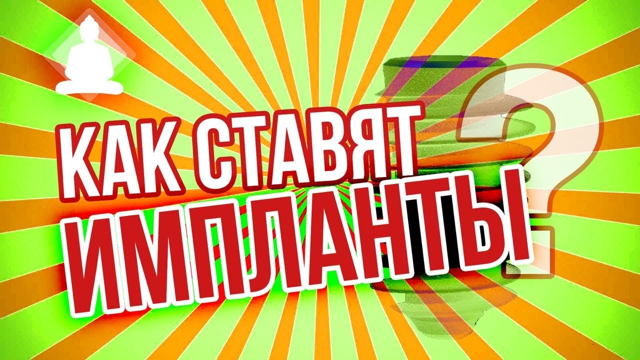 Как ставят зубные импланты?