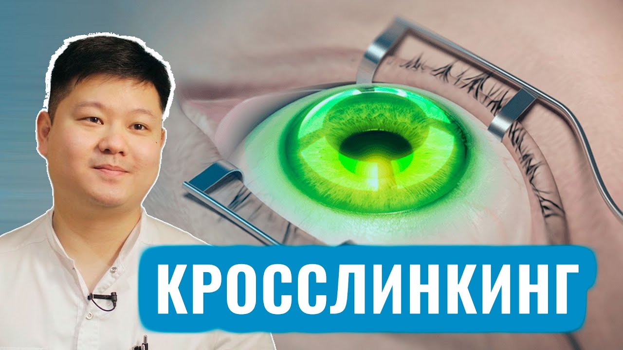 КРОССЛИНКИНГ РОГОВИЦЫ ПРИ КЕРАТОКОНУСЕ