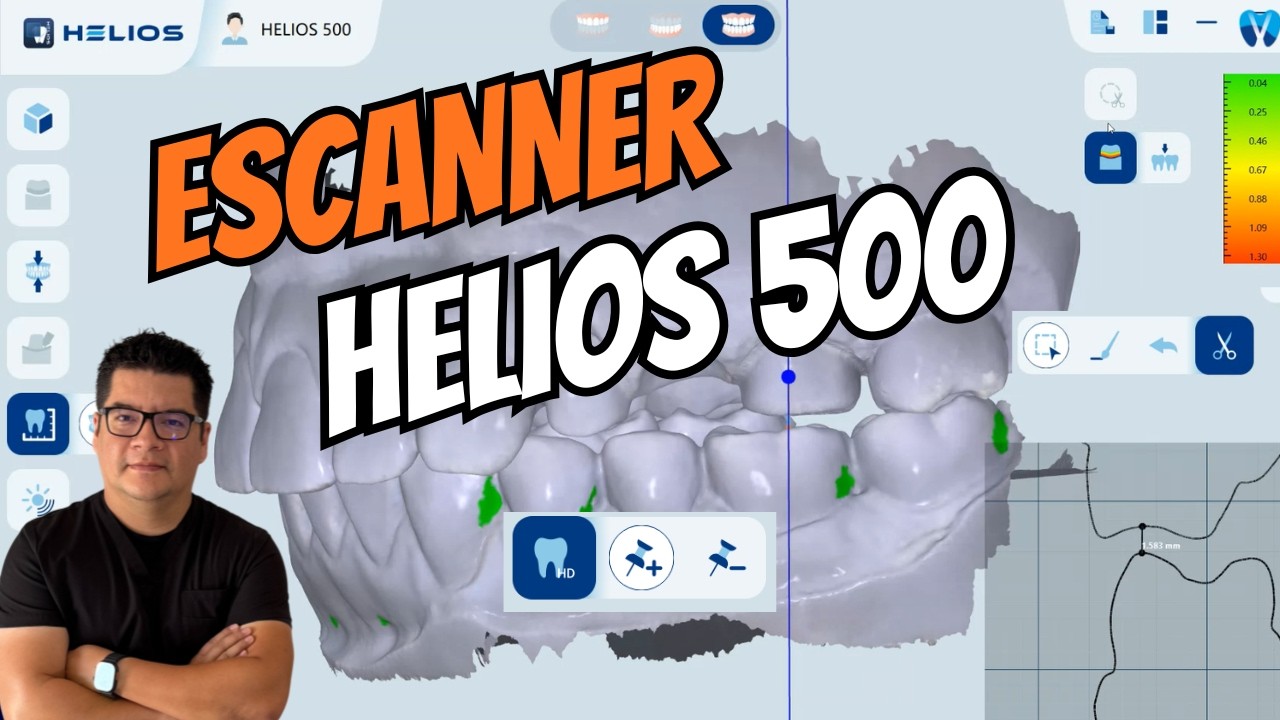 ESCANER DENTAL HELIOS 500