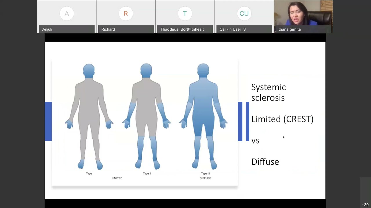 Systemic Sclerosis: Grand Rounds in Rheumatology
