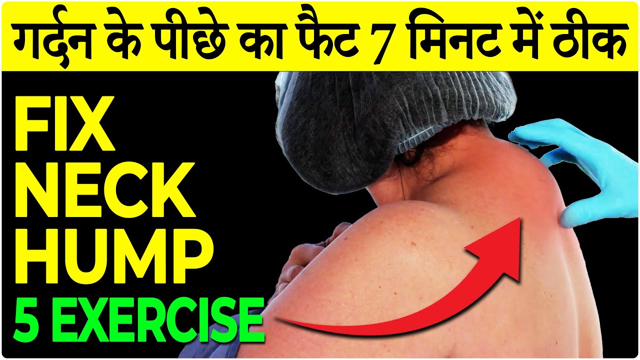 5 Neck Hump Exercises Hindi 2023 | Fix Neck Hump at Home