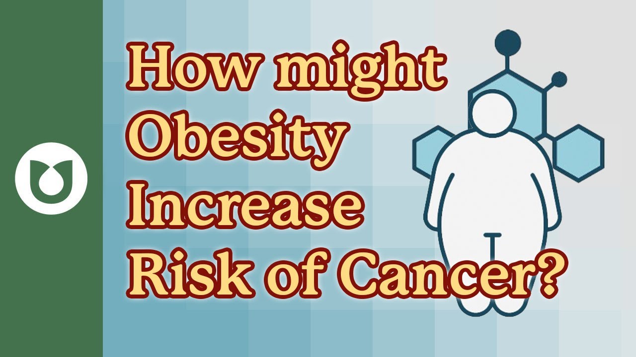 Could weight affect your myeloma risk?  