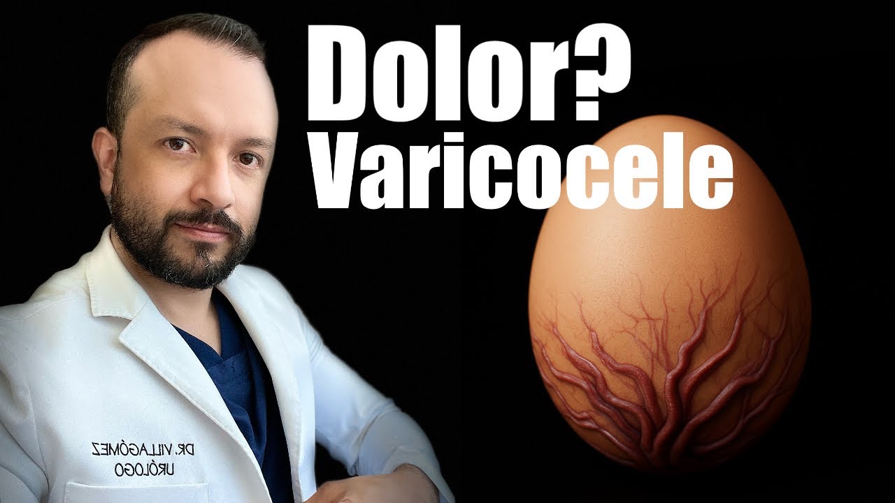 Resuelvo todas tus dudas | VARICOCELE | 