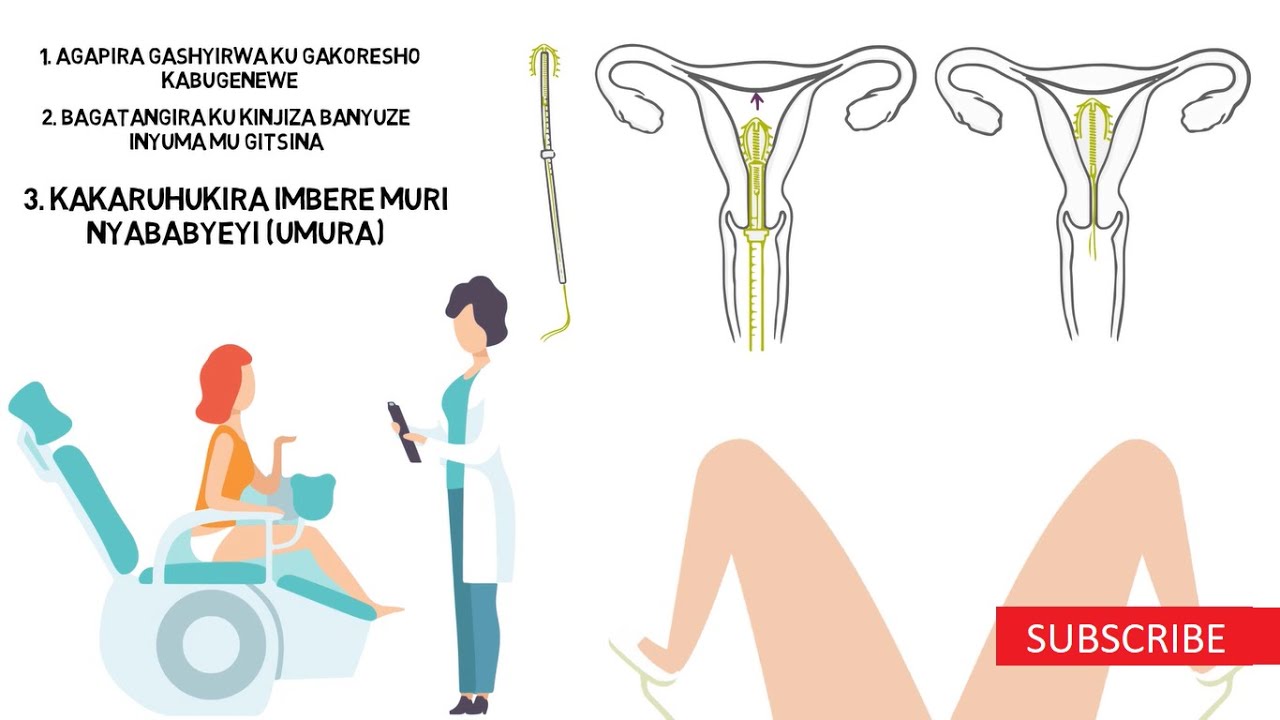 Kuboneza urubyaro na DIU: Agapira ko mu mura gafite umuringa