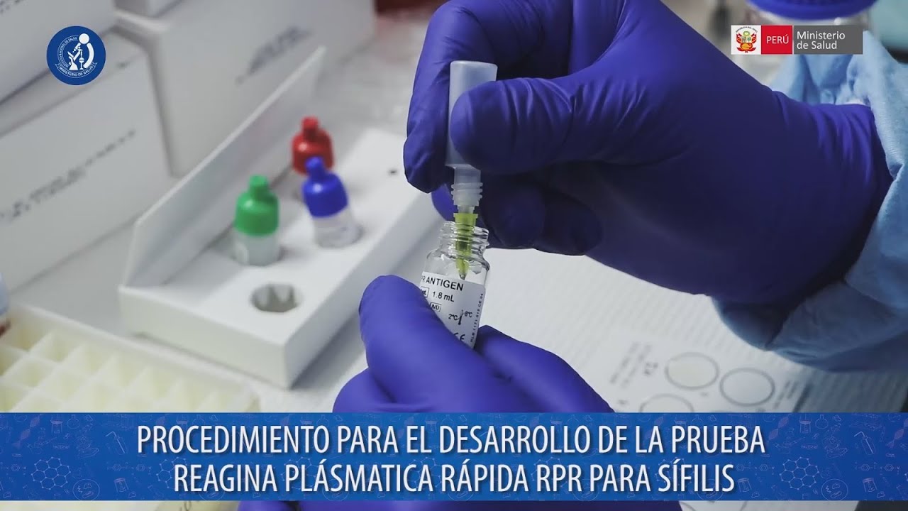 Desarrollo de la prueba Reagina Plásmatica Rápida (RPR) para el diagnóstico de Sífilis