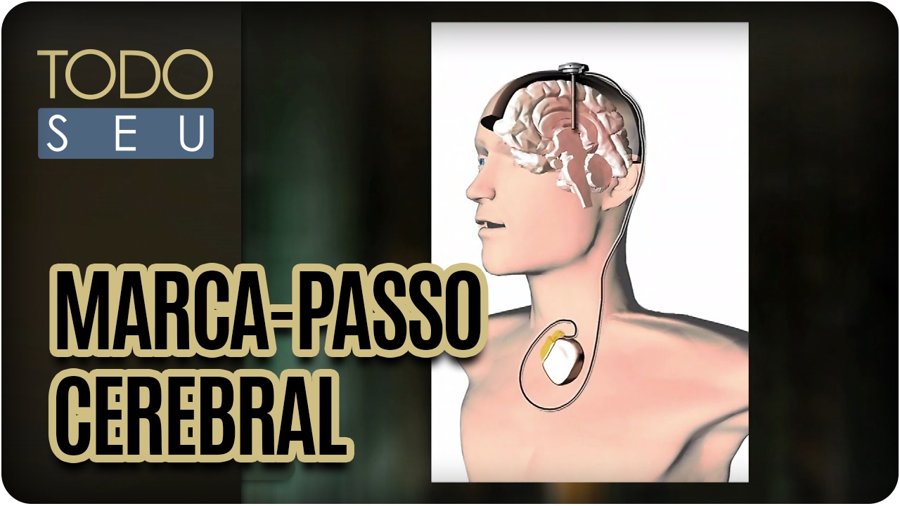 Marca-Passo Cerebral  - Todo Seu (14/02/17)