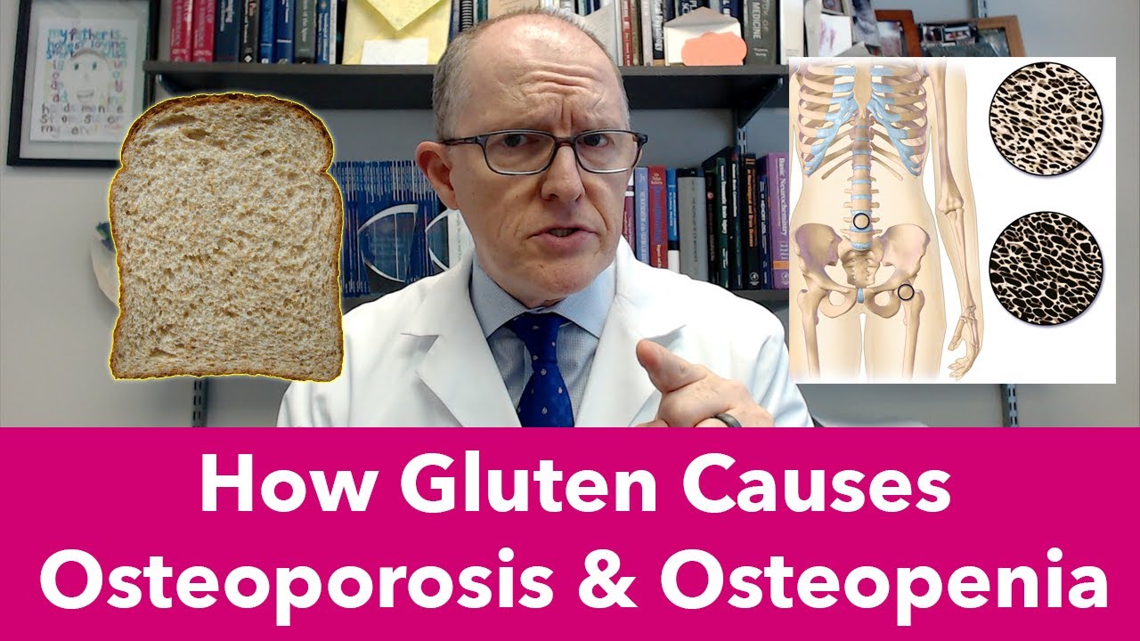 How Wheat & Gluten Cause Osteoporosis and Osteopenia