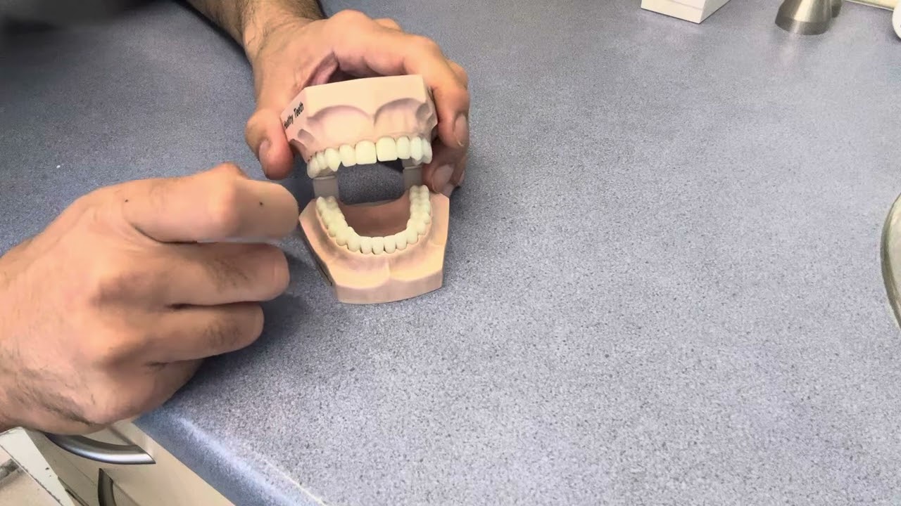 The Patient Asked So I Answered -  Should I Do Invisalign?