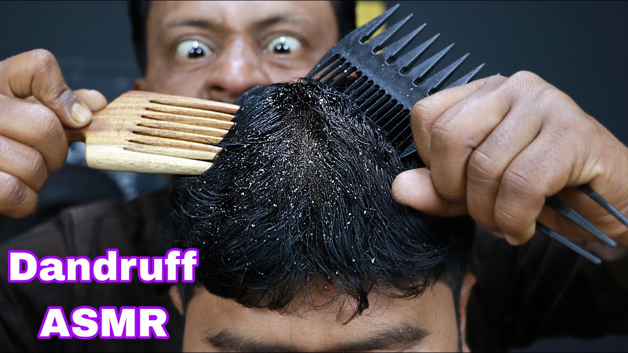Huge Dandruff Scratching ASMR | ASMR Dandruff Treatment | ASMR Dandruff Removal | Neck Cracking ASMR